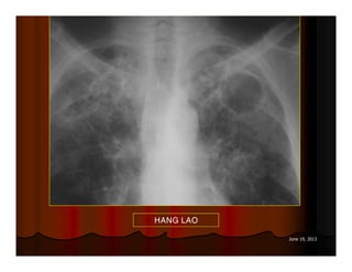 June 19, 2013
HANG LAO
 