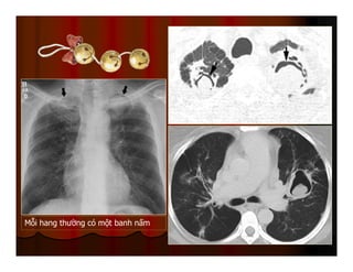Mỗi hang thường có một banh nấm
 
