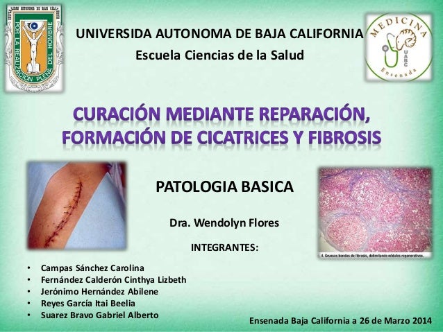 fibrosis en cicatrizacion