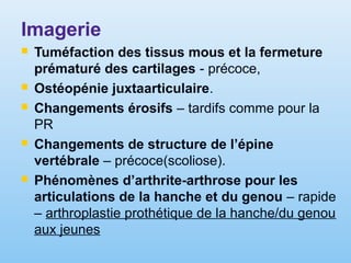 Imagerie
 Tuméfaction des tissus mous et la fermeture
prématuré des cartilages - précoce,
 Ostéopénie juxtaarticulaire.
 Changements érosifs – tardifs comme pour la
PR
 Changements de structure de l’épine
vertébrale – précoce(scoliose).
 Phénomènes d’arthrite-arthrose pour les
articulations de la hanche et du genou – rapide
– arthroplastie prothétique de la hanche/du genou
aux jeunes
 