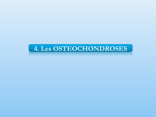 4. Les OSTEOCHONDROSES
 