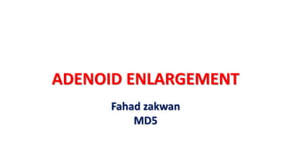 ADENOID ENLARGEMENT
Fahad zakwan
MD5
 