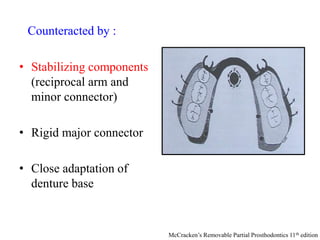 2. principles of designing rpd with special emphsis on support and ...