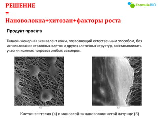 Продукт проекта
Тканеинженерная эквивалент кожи, позволяющий естественным способом, без
использования стволовых клеток и других клеточных структур, восстанавливать
участки кожных покровов любых размеров.
РЕШЕНИЕ
=
Нановолокна+хитозан+факторы роста
Клетки эпителия (а) и монослой на нановолокнистой матрице (б)
 