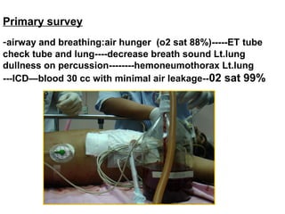 Primary survey
-airway and breathing:air hunger (o2 sat 88%)-----ET tube
check tube and lung----decrease breath sound Lt.lung
dullness on percussion--------hemoneumothorax Lt.lung
---ICD—blood 30 cc with minimal air leakage--02 sat 99%
 