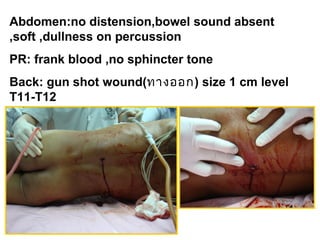 Abdomen:no distension,bowel sound absent
,soft ,dullness on percussion
PR: frank blood ,no sphincter tone
Back: gun shot wound(ทางออก) size 1 cm level
T11-T12
 