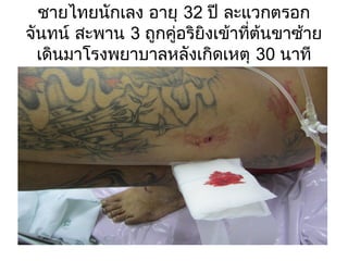ชายไทยนักเลง อายุ 32 ปี ละแวกตรอก
จันทน์ สะพาน 3 ถูกคู่อริยิงเข้าที่ต้นขาซ้าย
เดินมาโรงพยาบาลหลังเกิดเหตุ 30 นาที
 