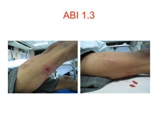 ABI 1.3
 
