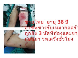 ชายไทย อายุ 38 ปี
อาชีพช่างรับเหมาก่อสร้า
ถูกยิง 3 นัดที่ท้องและขาซ
ก่อนมา รพ.ครึ่งชั่วโมง
 