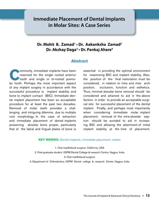 Immediate Implant Placement | PDF