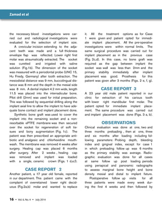 Immediate Implant Placement | PDF