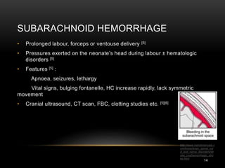 Cephalohematoma Vs Caput Succedaneum
