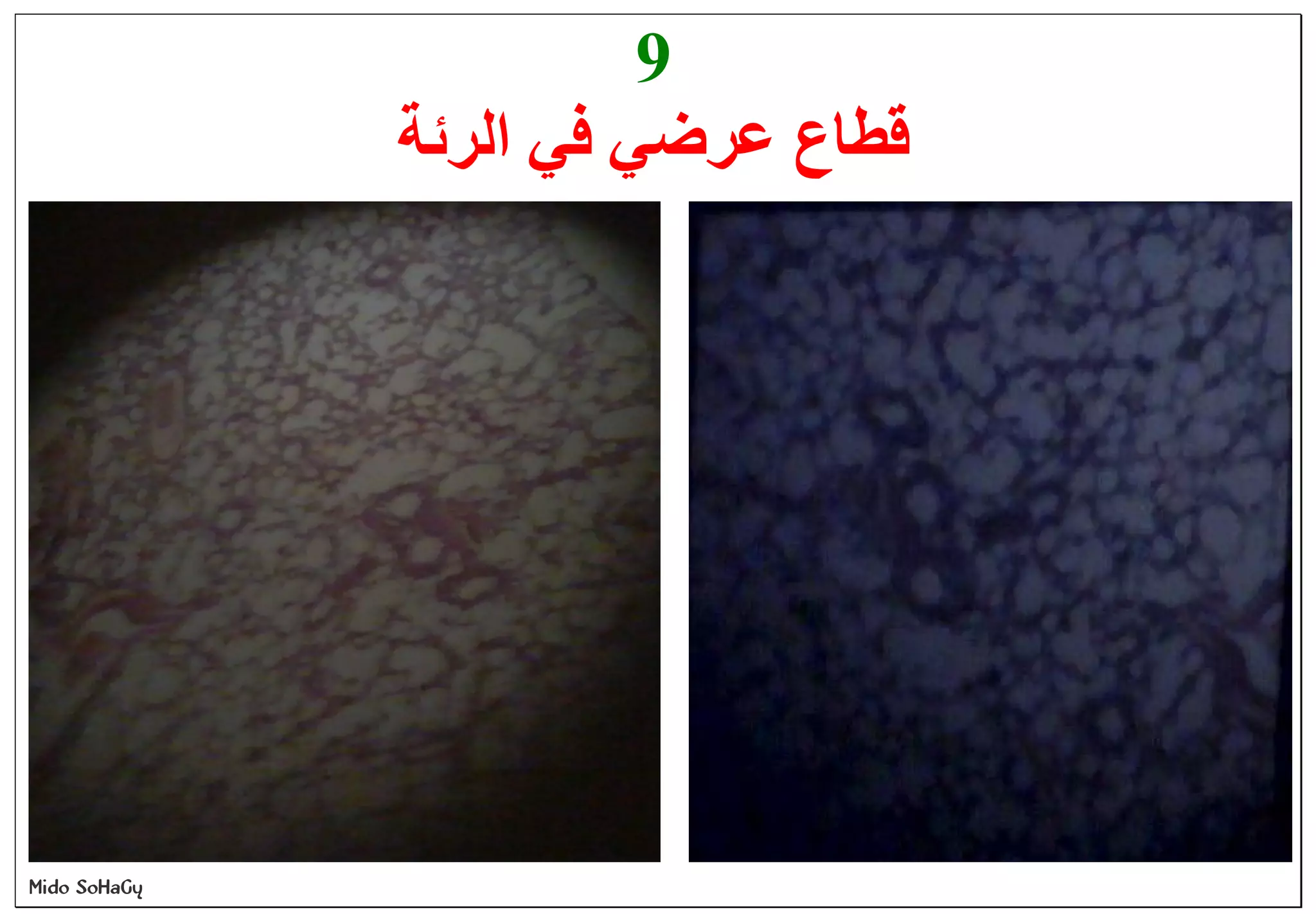 Mido SoHaGy
9
‫اﻟﺮﺋﺔ‬ ‫ﻓﻲ‬ ‫ﻋﺮﺿﻲ‬ ‫ﻗﻄﺎع‬
 