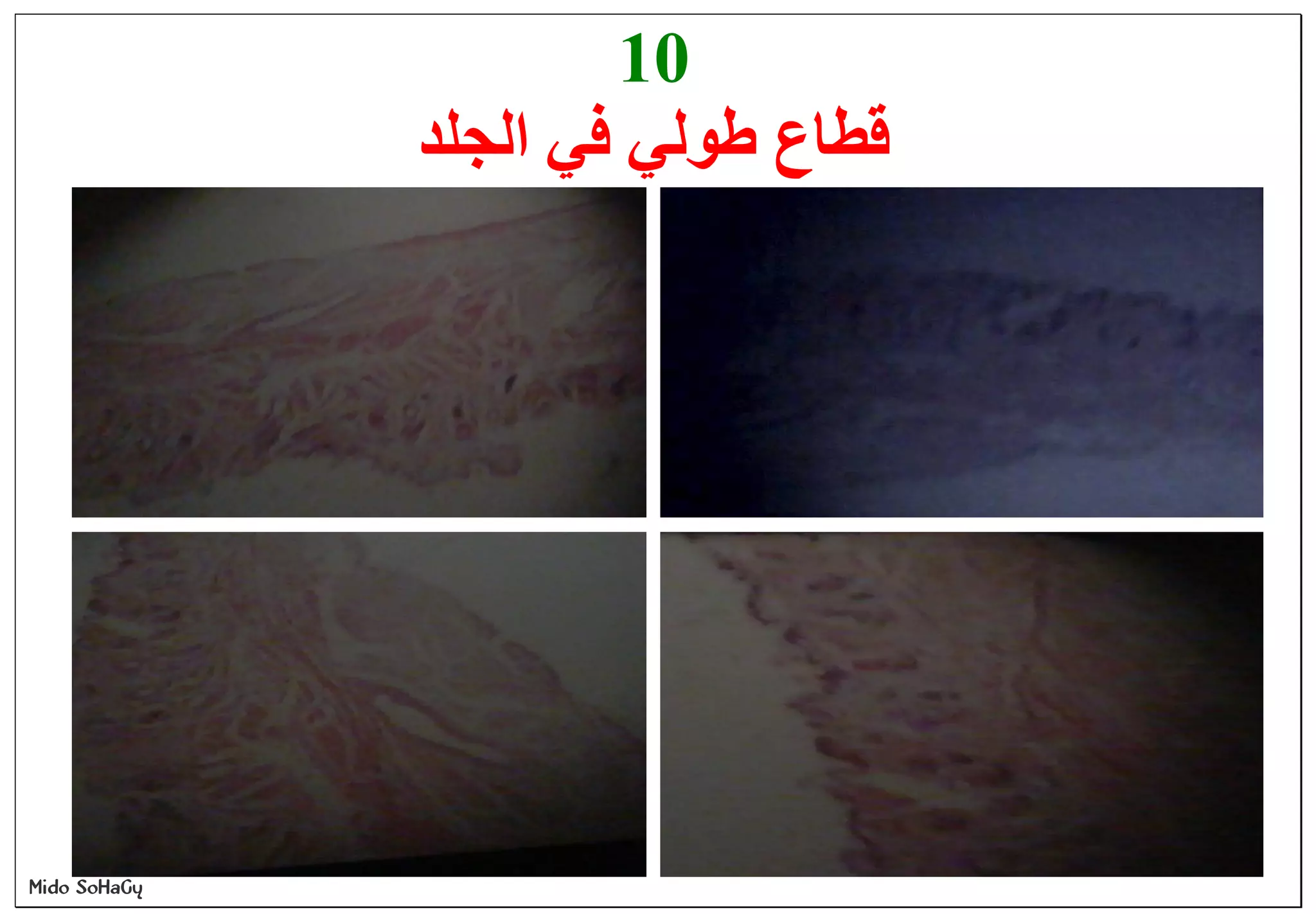 Mido SoHaGy
10
‫ﻗﻄﺎع‬‫ﻃﻮﻟﻲ‬‫ﻓﻲ‬‫اﻟﺠﻠﺪ‬
 