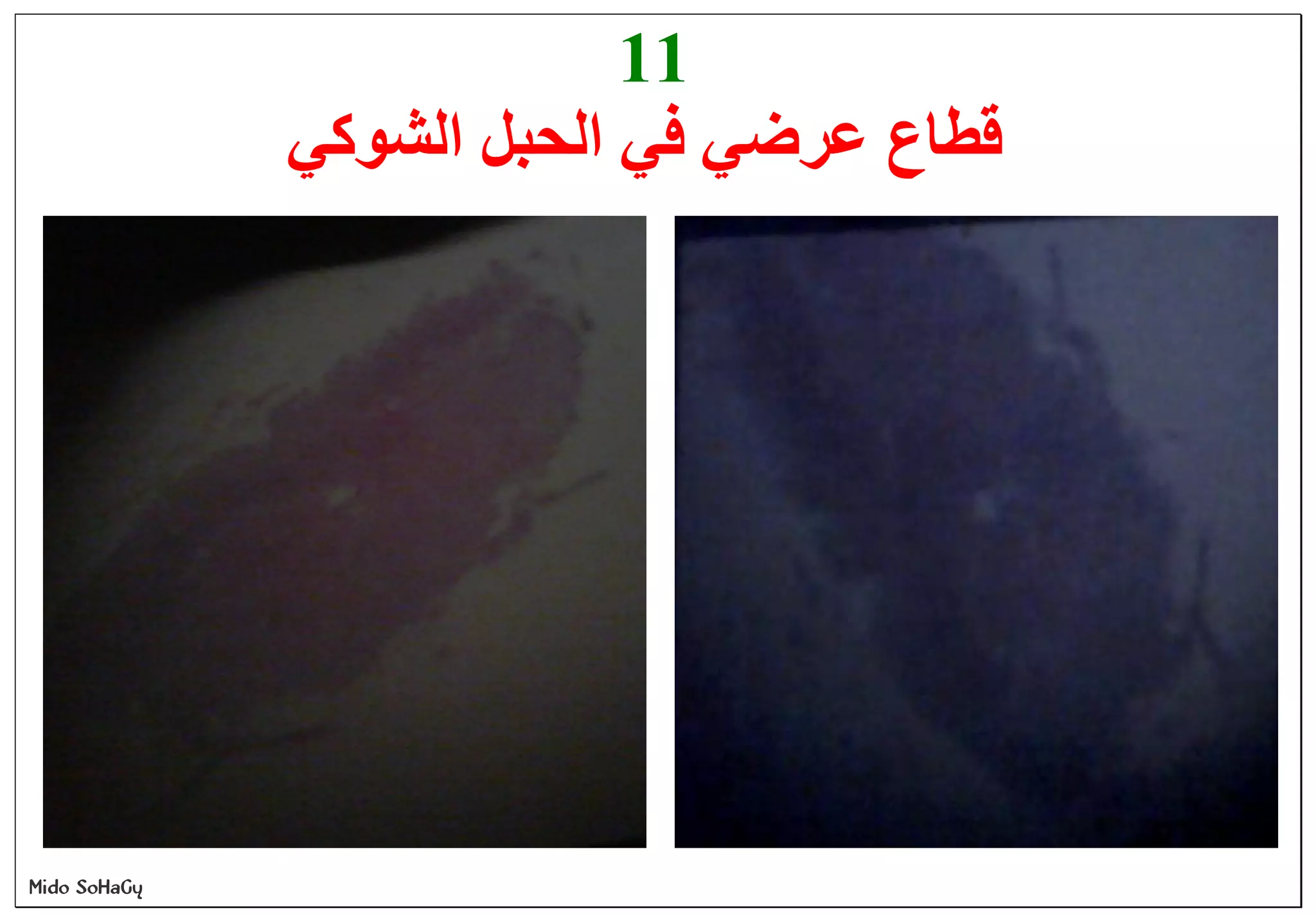 Mido SoHaGy
11
‫اﻟﺸﻮﻛﻲ‬ ‫اﻟﺤﺒﻞ‬ ‫ﻓﻲ‬ ‫ﻋﺮﺿﻲ‬ ‫ﻗﻄﺎع‬
 