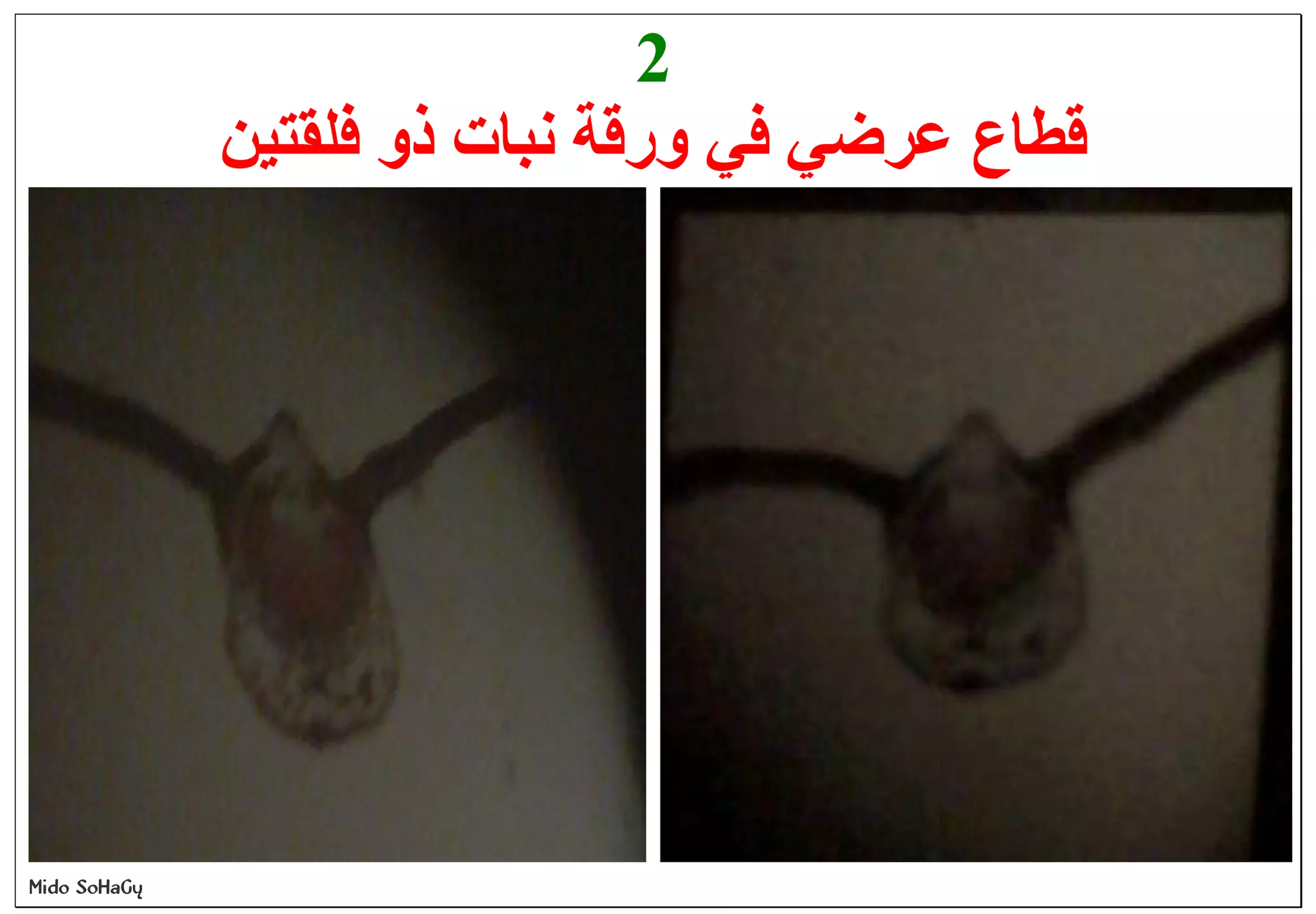 Mido SoHaGy
2
‫ﻓﻠﻘﺘﯿﻦ‬ ‫ذو‬ ‫ﻧﺒﺎت‬ ‫ورﻗﺔ‬ ‫ﻓﻲ‬ ‫ﻋﺮﺿﻲ‬ ‫ﻗﻄﺎع‬
 