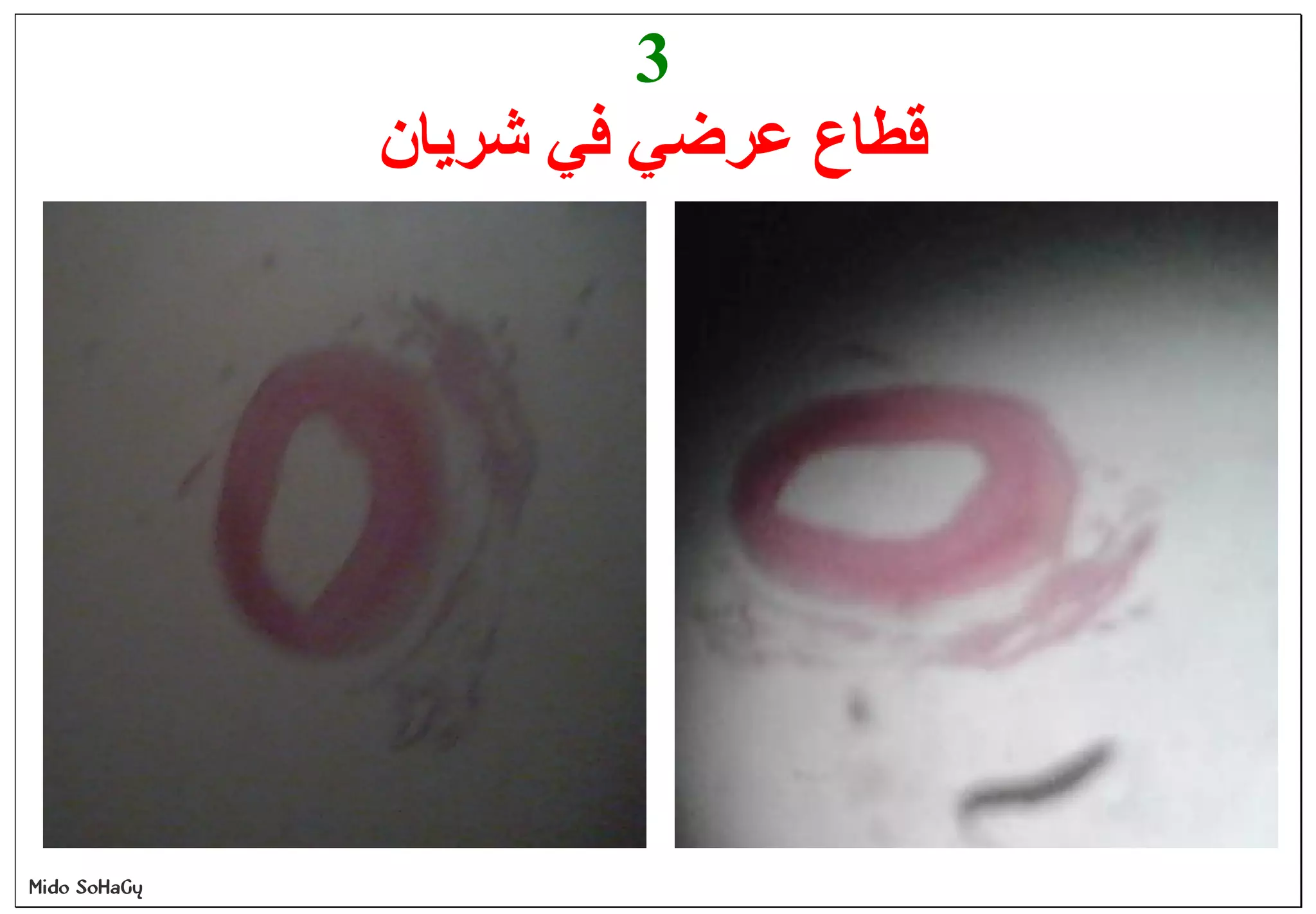 Mido SoHaGy
3
‫ﺷﺮﯾﺎن‬ ‫ﻓﻲ‬ ‫ﻋﺮﺿﻲ‬ ‫ﻗﻄﺎع‬
 