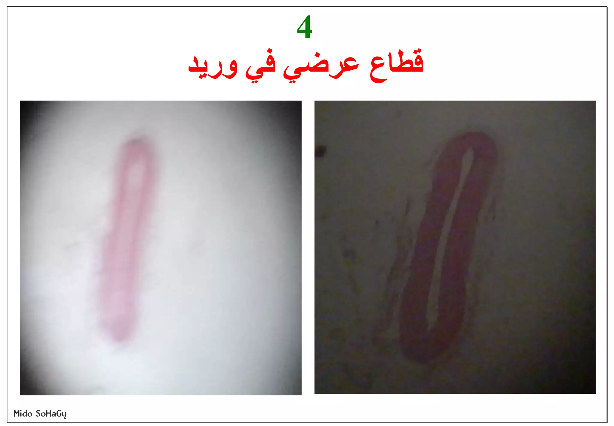 Mido SoHaGy
4
‫ورﯾﺪ‬ ‫ﻓﻲ‬ ‫ﻋﺮﺿﻲ‬ ‫ﻗﻄﺎع‬
 