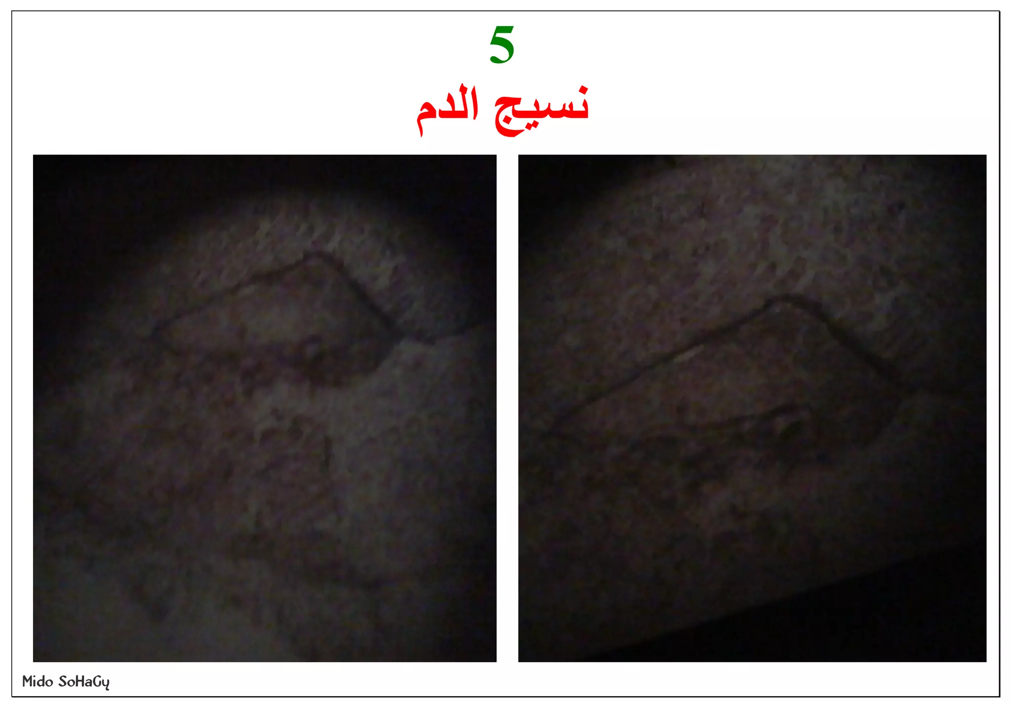 Mido SoHaGy
5
‫ﻧﺴﯿﺞ‬‫اﻟ‬‫ﺪم‬
 