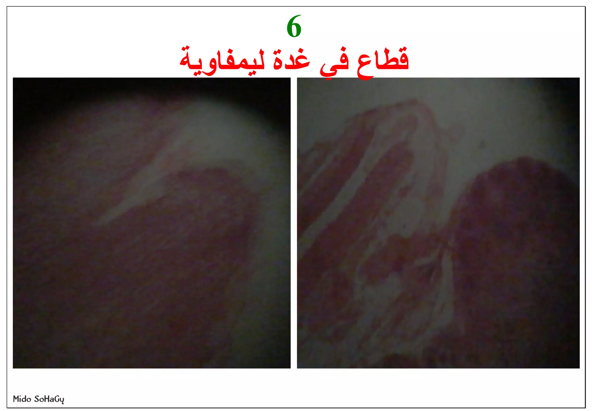 Mido SoHaGy
6
‫ﻟﯿﻤﻔﺎوﯾﺔ‬ ‫ﻏﺪة‬ ‫ﻓﻲ‬ ‫ﻗﻄﺎع‬
 