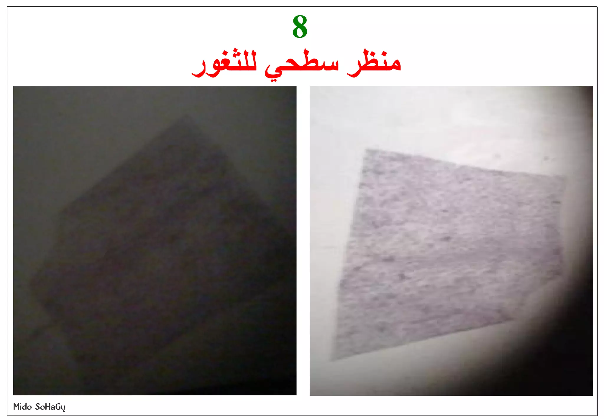 Mido SoHaGy
8
‫ﻟﻠﺜﻐﻮر‬ ‫ﺳﻄﺤﻲ‬ ‫ﻣﻨﻈﺮ‬
 