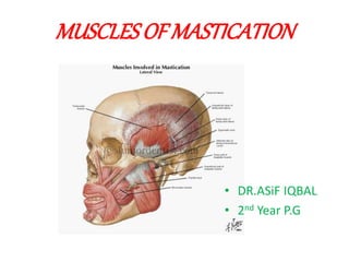 MUSCLES OF MASTICATION 
• DR.ASiF IQBAL 
• 2nd Year P.G 
 