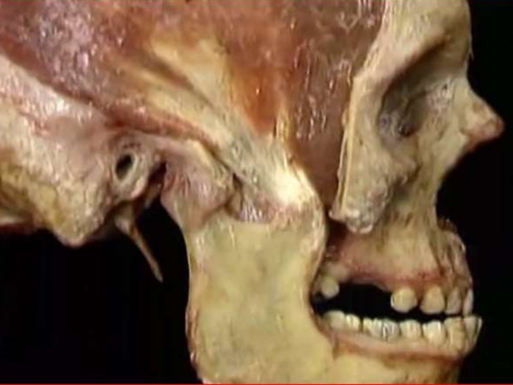 Muscles of mastication