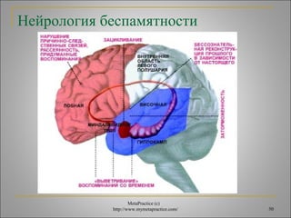 Нейрология беспамятности 
MetaPractice (с) 
http://www.mymetapractice.com/ 50 
 