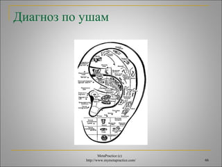 Диагноз по ушам 
MetaPractice (с) 
http://www.mymetapractice.com/ 66 
 