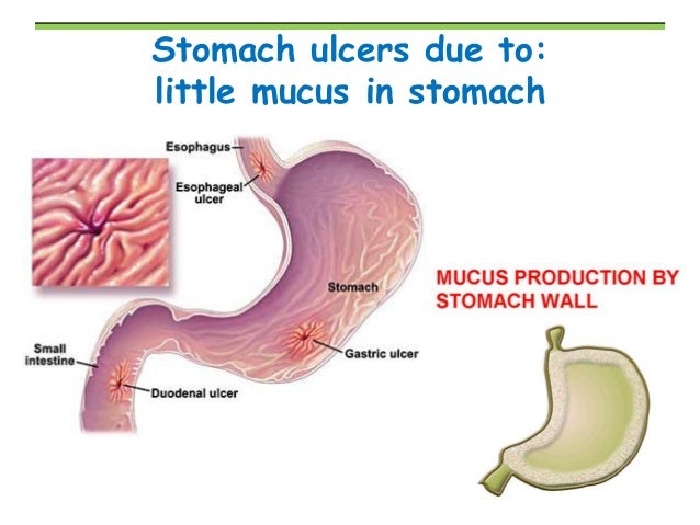 biology form 4 chapter 6 nutrition part 2 what cells in the stomach form enzymes and acids