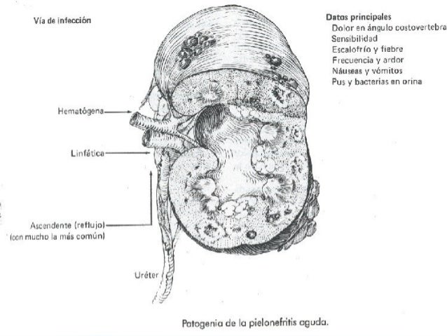 Priligy medication