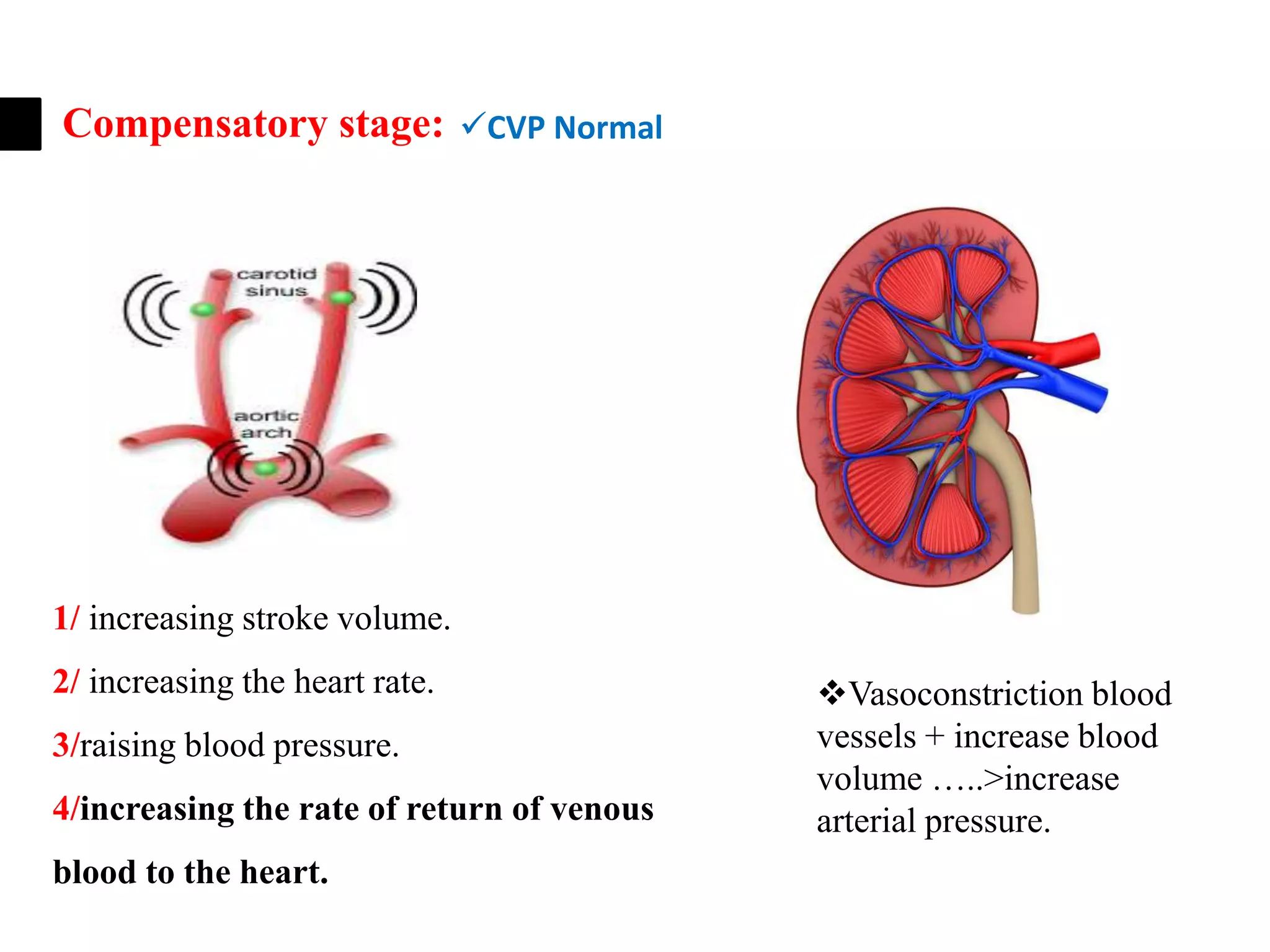 The CVP in hypovolemic shock. | PPTX