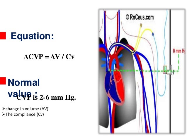 central venous pressure