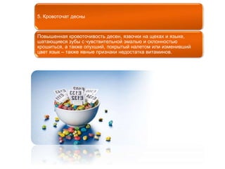 5. Кровоточат десны 
Повышенная кровоточивость десен, язвочки на щеках и языке, 
шатающиеся зубы с чувствительной эмалью и склонностью 
крошиться, а также опухший, покрытый налетом или изменивший 
цвет язык – также явные признаки недостатка витаминов. 
 