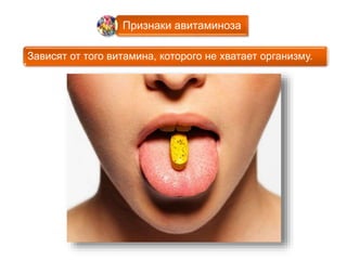 Признаки авитаминоза 
Зависят от того витамина, которого не хватает организму. 
 