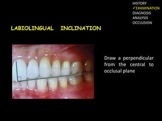 Labiolingually 2.diagnosis restoration of worn dentition | PPTX