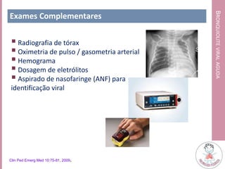 BRONQUIOLITEVIRALAGUDA
Exames Complementares
 Radiografia de tórax
 Oximetria de pulso / gasometria arterial
 Hemograma
 Dosagem de eletrólitos
 Aspirado de nasofaringe (ANF) para
identificação viral
Clin Ped Emerg Med 10:75-81, 2009.
 