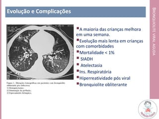 BRONQUIOLITEVIRALAGUDA
Evolução e Complicações
A maioria das crianças melhora
em uma semana.
Evolução mais lenta em crianças
com comorbidades
Mortalidade < 1%
 SIADH
 Atelectasia
Ins. Respiratória
Hiperreatividade pós viral
Bronquiolite obliterante
 