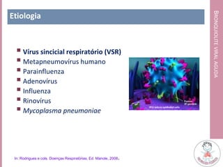 BRONQUIOLITEVIRALAGUDA
Etiologia
 Vírus sincicial respiratório (VSR)
 Metapneumovírus humano
 Parainfluenza
 Adenovírus
 Influenza
 Rinovírus
 Mycoplasma pneumoniae
In: Rodrigues e cols. Doenças Respiratórias, Ed. Manole, 2008.
 