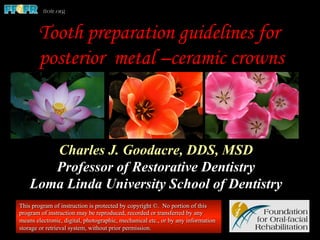 Tooth preparation guidelines for
posterior metal –ceramic crowns
Charles J. Goodacre, DDS, MSD
Professor of Restorative Dentistry
Loma Linda University School of Dentistry
This program of instruction is protected by copyright ©. No portion of this
program of instruction may be reproduced, recorded or transferred by any
means electronic, digital, photographic, mechanical etc., or by any information
storage or retrieval system, without prior permission.
 