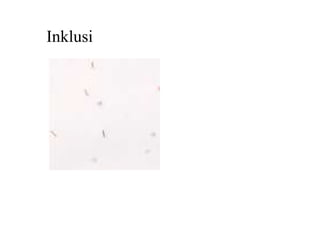 Inklusi
 
