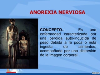 ANOREXIA NERVIOSA
CONCEPTO.- Es una
enfermedad caracterizada por
una pérdida auto-inducida de
peso debida a la poca o nula
ingesta de alimentos,
acompañada por una distorsión
de la imagen corporal.
 