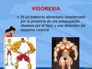 VIGOREXIA
• Es un trastorno alimentario caracterizado
por la presencia de una preocupación
obsesiva por el físico y una distorsión del
esquema corporal.
 