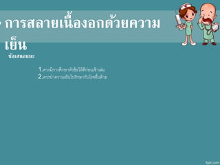 1.คารมีการศึกษาหัาข้อให้ดีกีก่อนเข้าเล่ม
2.คารนาคาามเย็นไปรักษากับโรคอื่นดีก้าย
ข้อเสนอแนะ
•การสลายเนื้องอกด้วยความ
เย็น
 