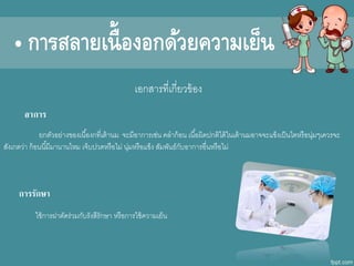 เอกสารที่เกี่ยาข้อง
อาการ
ยกตัาอย่างของเนื้องกที่เต้านม จะมีอาการเช่น คลาก้อน เนื้อผิดีกปกติไดีก้ในเต้านมอาจจะแข็งเป็นไตหรือนุ่ม เคารจะ
สังเกตา่า ก้อนนี้มีมานานไหม เจ็บปาดีกหรือไม่ นุ่มหรือแข็ง สัมพันธ์กับอาการอื่นหรือไม่
การรักษา
ใช้การผ่าตัดีกร่ามกับรังสีรักษา หรือการใช้คาามเย็น
• การสลายเนื้องอกด้วยความเย็น
 