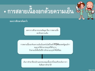 ผลการศึกษาค้นคว้า
ผลจากการศึกษาราบรามข้อมูล เรื่อง การสลายเนื้อ
งอกดีก้ายคาามเย็น
การสลายเนื้องอกดีก้ายคาามเย็นเป็นเทคโนโลยีใหม่ที่ FDAของสหรัฐอเมริกา
อนุญาตให้นามาประยุกต์ใช้กับการ
รักษามะเร็งซึ่งเป็นาิธีการรักษาแบบรุกล้าพื้นที่น้อย
เป็นการรักษาที่ตรงเป้ าและครอบคลุมเนื้องอกทั้งหมดีกจึงจะเป็นการกา
รันตีผลการรักษาไดีก้
• การสลายเนื้องอกด้วยความเย็น
 