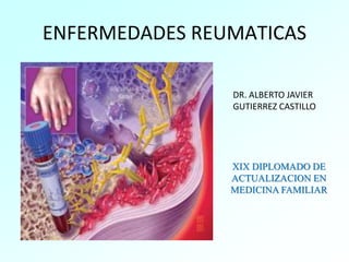 ENFERMEDADES REUMATICAS
DR. ALBERTO JAVIER
GUTIERREZ CASTILLO
XIX DIPLOMADO DE
ACTUALIZACION EN
MEDICINA FAMILIAR
 