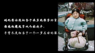 她的面容像一个十多岁的孩子，
身高仅是正常成人的一半，
手臂长度相当于一个一岁左右的婴儿。
别人干一天相当于她三天半劳动量，
但她却撑起了一个家庭。
 