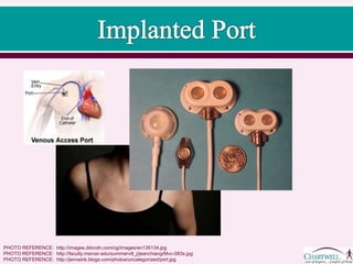 PHOTO REFERENCE: http://images.ddccdn.com/cg/images/en135134.jpg
PHOTO REFERENCE: http://jenneink.blogs.com/photos/uncategorized/port.jpg
PHOTO REFERENCE: http://faculty.mercer.edu/summervill_j/jeanchiang/Mvc-083s.jpg
 