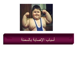 ‫بالسمنة‬ ‫الصابة‬ ‫أمسباب‬
 